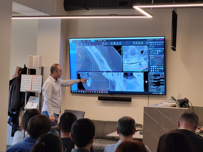 BIOTECH DENTAL իմպլանտացիոն համակարգի առանձնահատկությունները